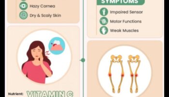 Nepieciešamās uzturvielas: stratēģijas parasto trūkumu novēršanai